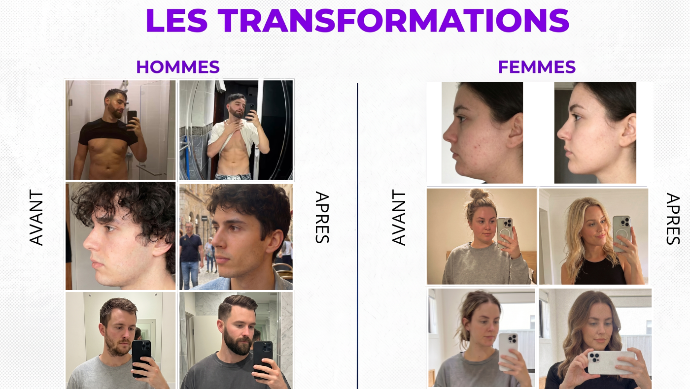 Transformations avant/après des membres Aura Lab — hommes et femmes